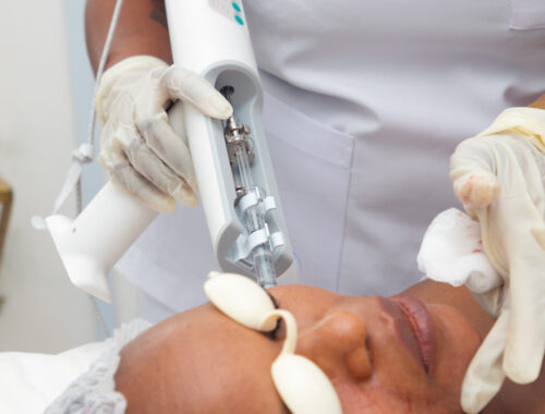 MESOTHERAPY
