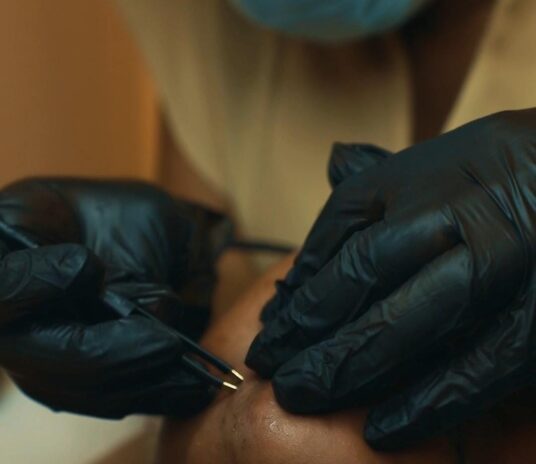 electrolysis